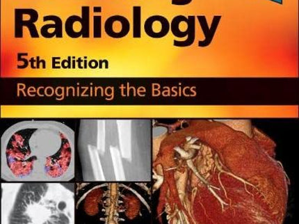 Learning Radiology