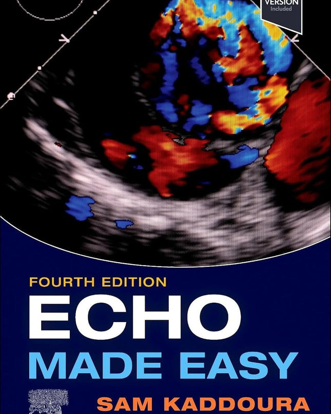 Echo Made Easy