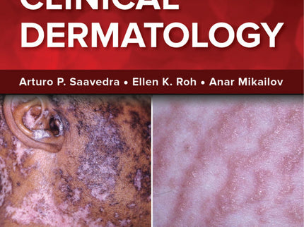 Fitzpatrick's Color Atlas And Synopsis Of Clinical Dermatology, Ninth Edition