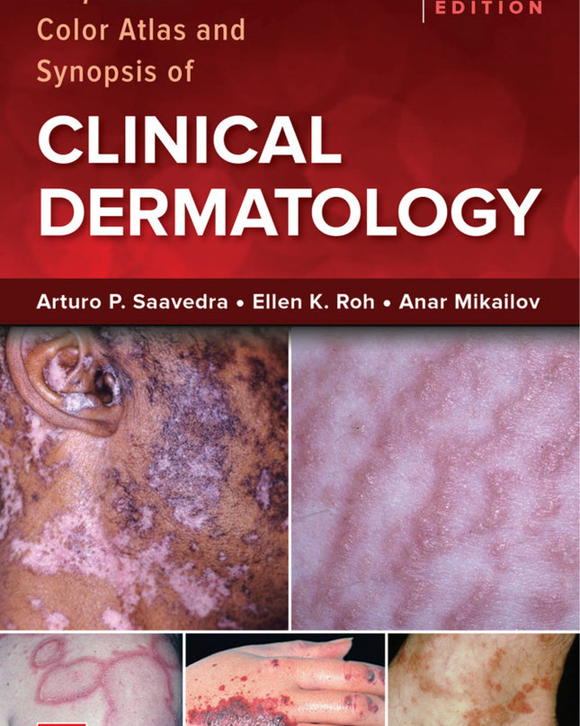 Fitzpatrick's Color Atlas And Synopsis Of Clinical Dermatology, Ninth Edition