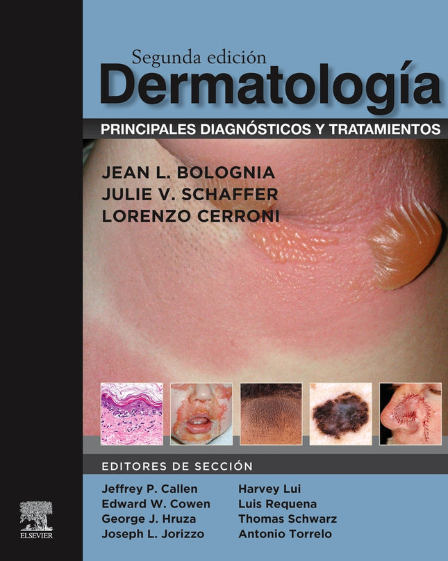 Dermatología: Principales Diagnósticos Y Tratamientos (2ª Ed.)