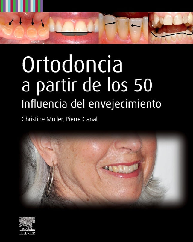 Ortodoncia A Partir De Los 50
