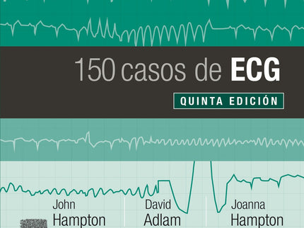 150 Casos De Ecg