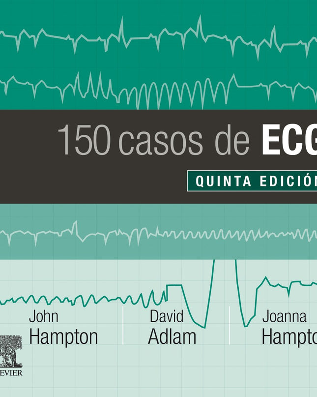 150 Casos De Ecg