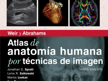 Atlas De Anatomía Humana Por Técnicas De Imagen